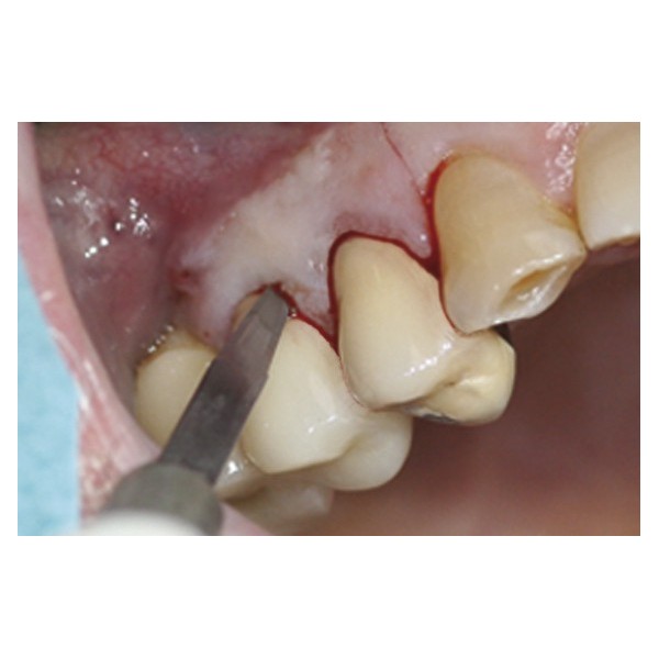 Boîte de 10 lames de bistouri stériles MJK -  35.75€ TTC