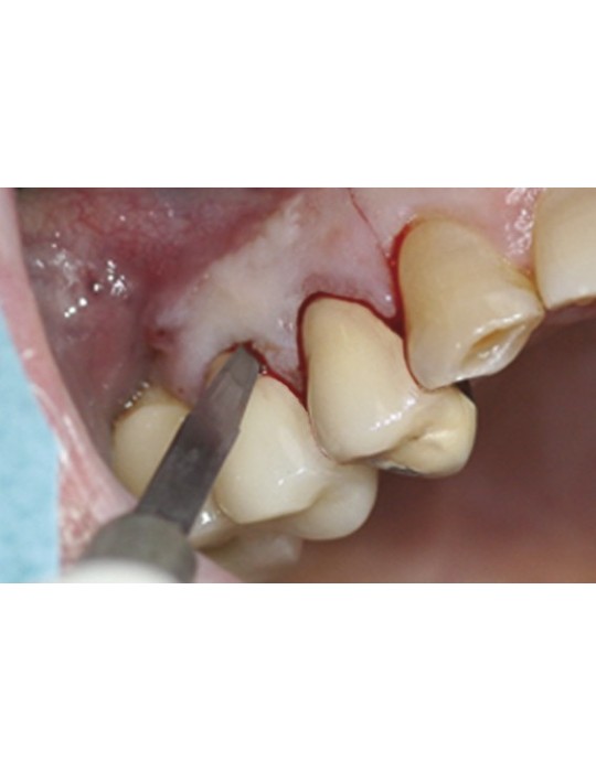 Boîte de 10 lames de bistouri stériles MJK -  35.75€ TTC